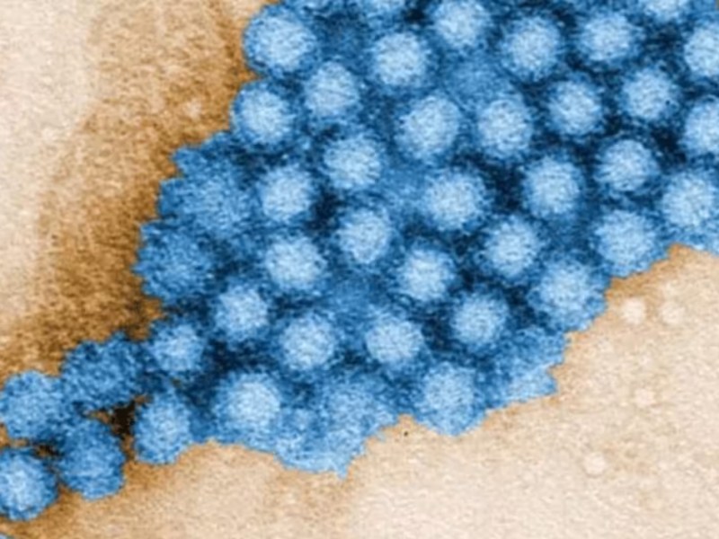 Casos de norovirus aumentan en EEUU pero no te preocupes, los CDC dicen que es normal