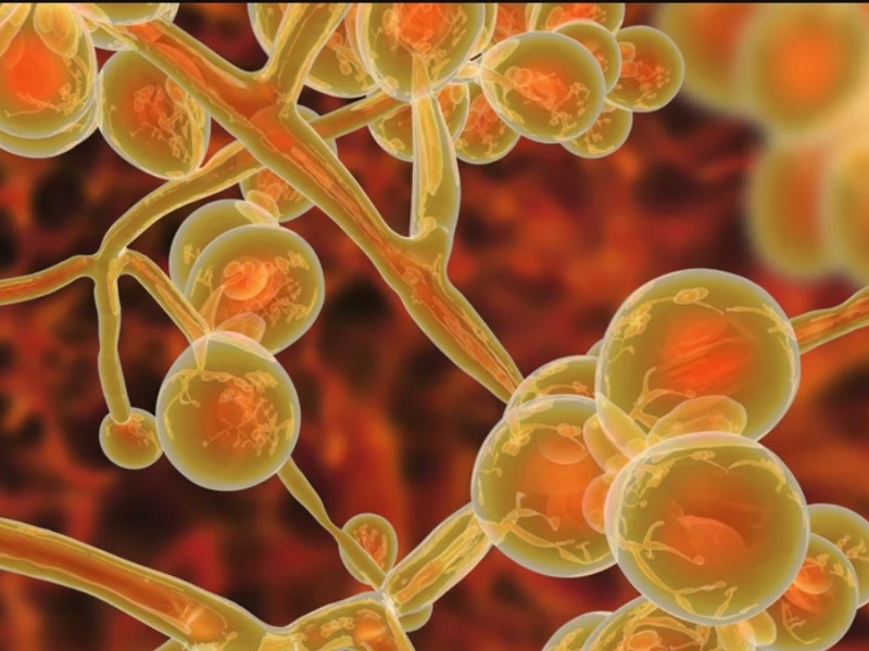 CDC: Una infección con hongos se propaga a ritmo alarmente y puede ser mortal